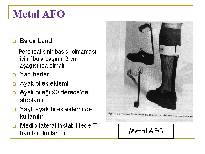 Metal AFO q Baldır bandı Peroneal sinir basısı olmaması için fibula başının 3 cm