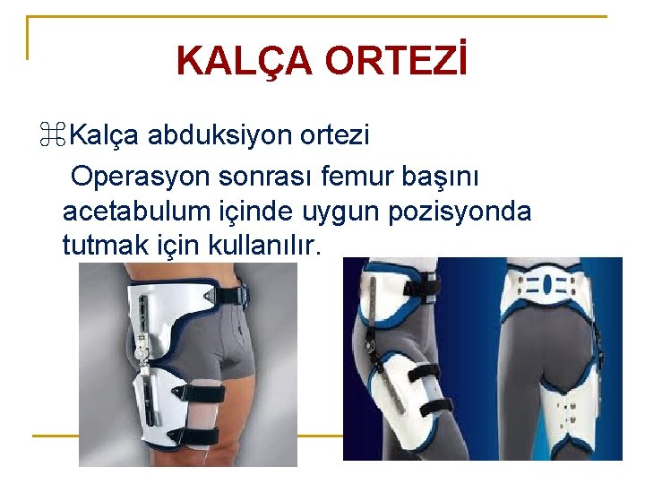 KALÇA ORTEZİ ⌘Kalça abduksiyon ortezi Operasyon sonrası femur başını acetabulum içinde uygun pozisyonda tutmak