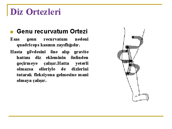 Diz Ortezleri n Genu recurvatum Ortezi Esas genu recurvatum nedeni quadriceps kasının zayıflığıdır. Hasta