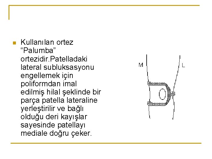 n Kullanılan ortez “Palumba” ortezidir. Patelladaki lateral subluksasyonu engellemek için poliformdan imal edilmiş hilal