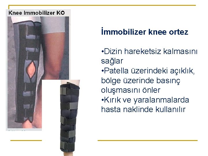 İmmobilizer knee ortez • Dizin hareketsiz kalmasını sağlar • Patella üzerindeki açıklık, bölge üzerinde