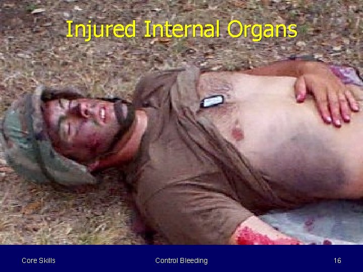 Injured Internal Organs Core Skills Control Bleeding 16 