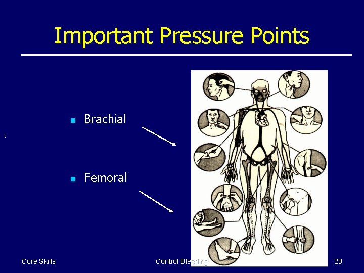 Important Pressure Points n Brachial n Femoral ( Core Skills Control Bleeding 23 