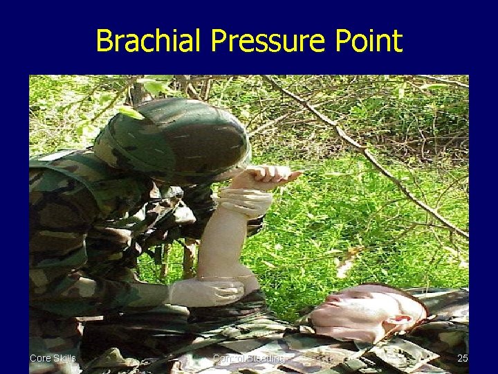 Brachial Pressure Point Core Skills Control Bleeding 25 