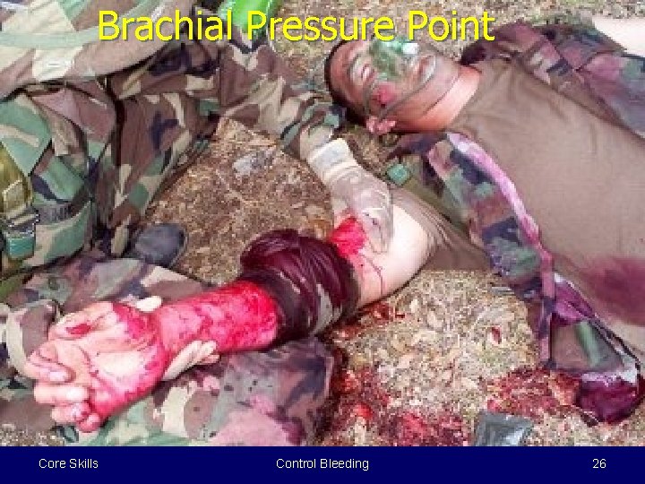 Brachial Pressure Point Core Skills Control Bleeding 26 