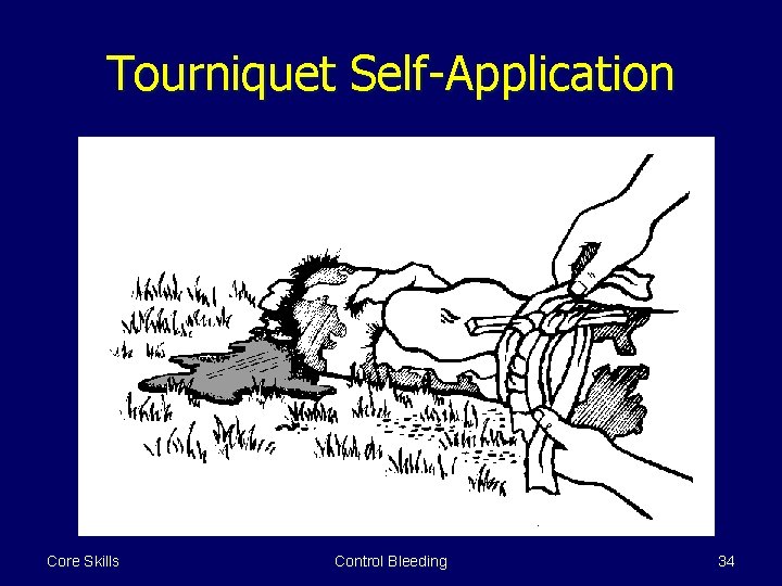 Tourniquet Self-Application Core Skills Control Bleeding 34 