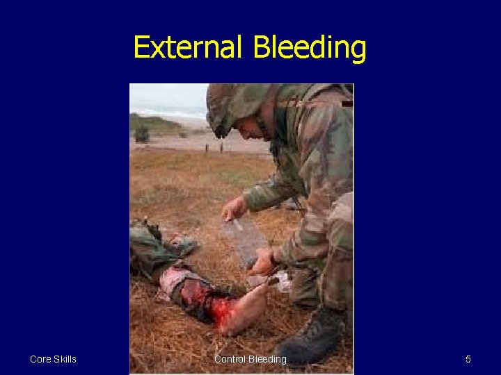 External Bleeding Core Skills Control Bleeding 5 