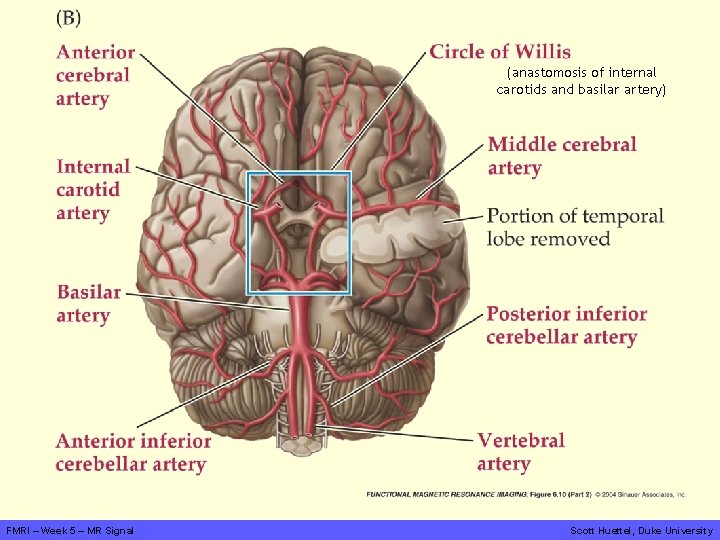 (anastomosis of internal carotids and basilar artery) FMRI – Week 5 – MR Signal