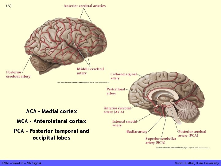 ACA – Medial cortex MCA – Anterolateral cortex PCA – Posterior temporal and occipital