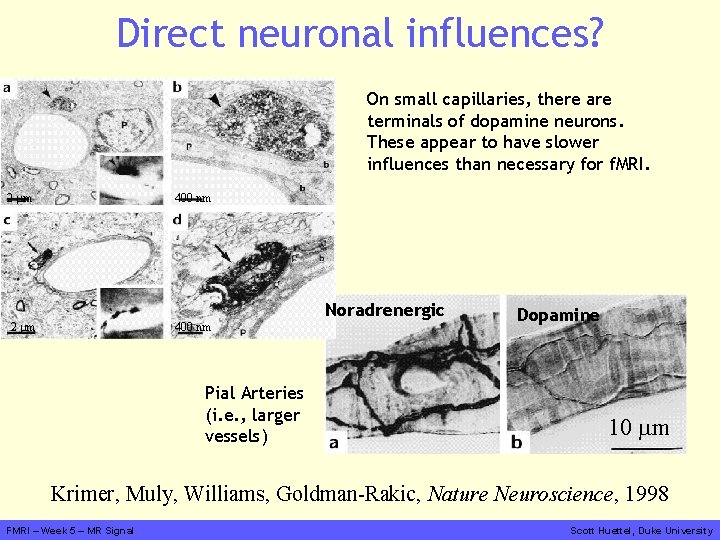 Direct neuronal influences? On small capillaries, there are terminals of dopamine neurons. These appear