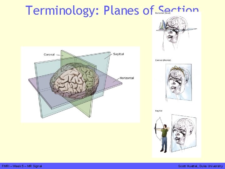 Terminology: Planes of Section FMRI – Week 5 – MR Signal Scott Huettel, Duke