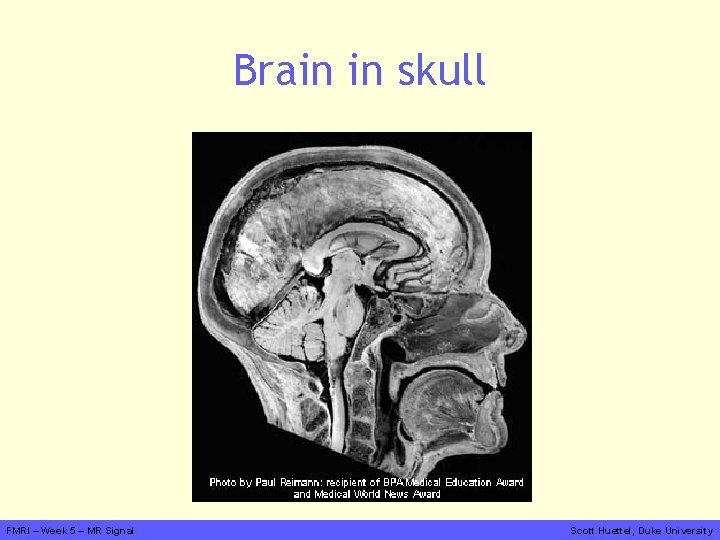 Brain in skull FMRI – Week 5 – MR Signal Scott Huettel, Duke University