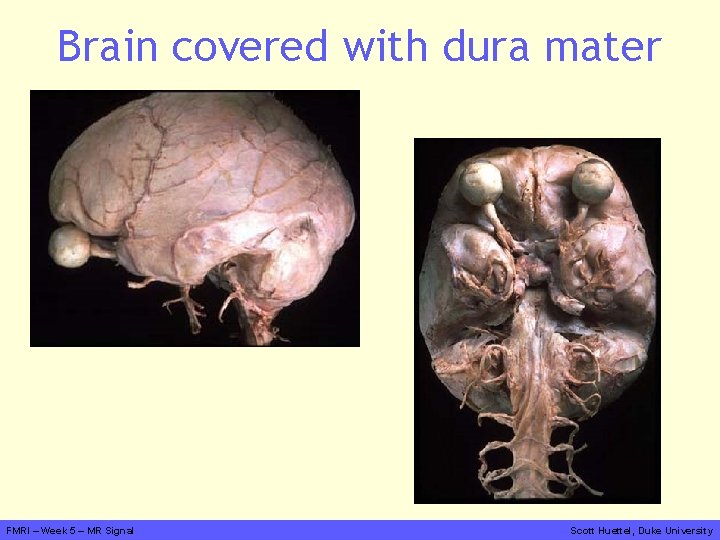 Brain covered with dura mater FMRI – Week 5 – MR Signal Scott Huettel,