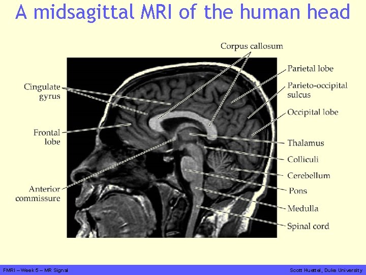 A midsagittal MRI of the human head FMRI – Week 5 – MR Signal