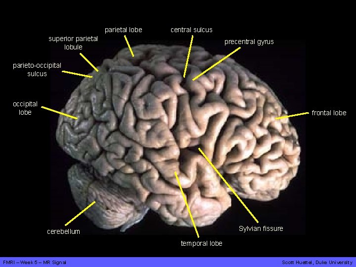 parietal lobe central sulcus superior parietal lobule precentral gyrus parieto-occipital sulcus occipital lobe frontal