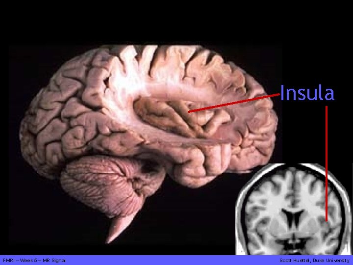 Insula FMRI – Week 5 – MR Signal Scott Huettel, Duke University 