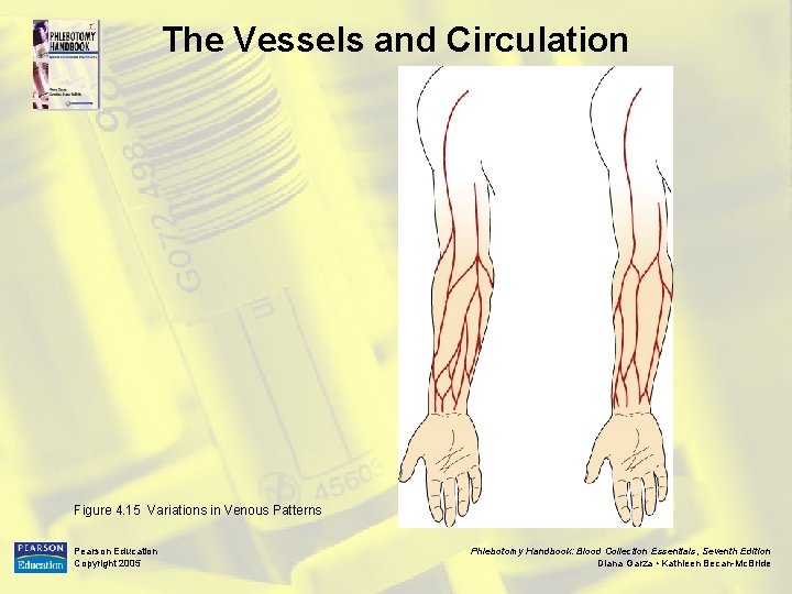 The Vessels and Circulation Figure 4. 15 Variations in Venous Patterns Pearson Education Copyright