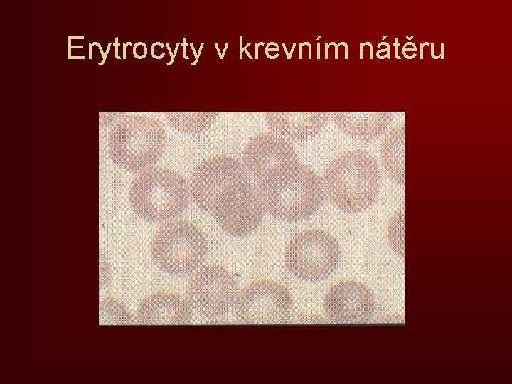 Erytrocyty v krevním nátěru 