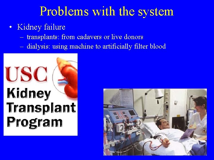 Problems with the system • Kidney failure – transplants: from cadavers or live donors