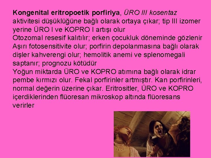 Kongenital eritropoetik porfiriya, ÜRO III kosentaz aktivitesi düşüklüğüne bağlı olarak ortaya çıkar; tip III