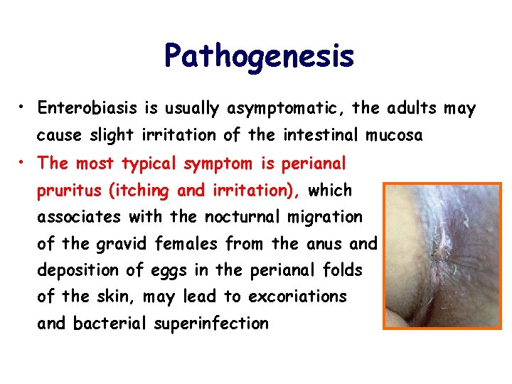Pathogenesis • Enterobiasis is usually asymptomatic, the adults may cause slight irritation of the