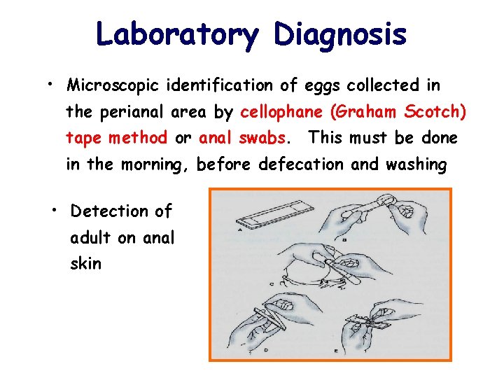 Laboratory Diagnosis • Microscopic identification of eggs collected in the perianal area by cellophane