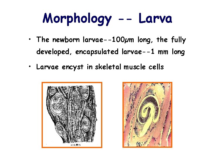 Morphology -- Larva • The newborn larvae--100µm long, the fully developed, encapsulated larvae--1 mm