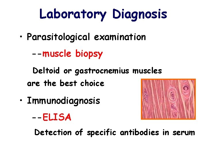 Laboratory Diagnosis • Parasitological examination --muscle biopsy Deltoid or gastrocnemius muscles are the best