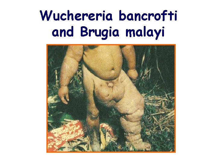 Wuchereria bancrofti and Brugia malayi 