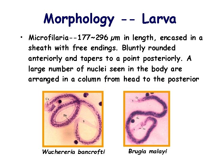Morphology -- Larva • Microfilaria--177~296 µm in length, encased in a sheath with free
