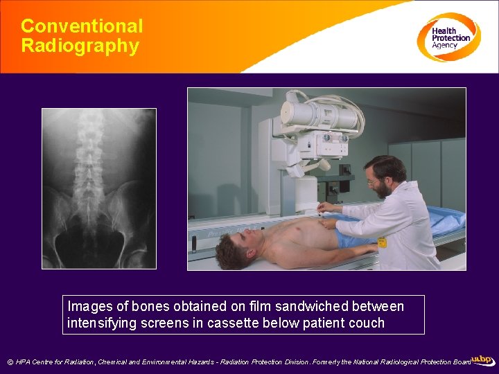 Conventional Radiography Images of bones obtained on film sandwiched between intensifying screens in cassette