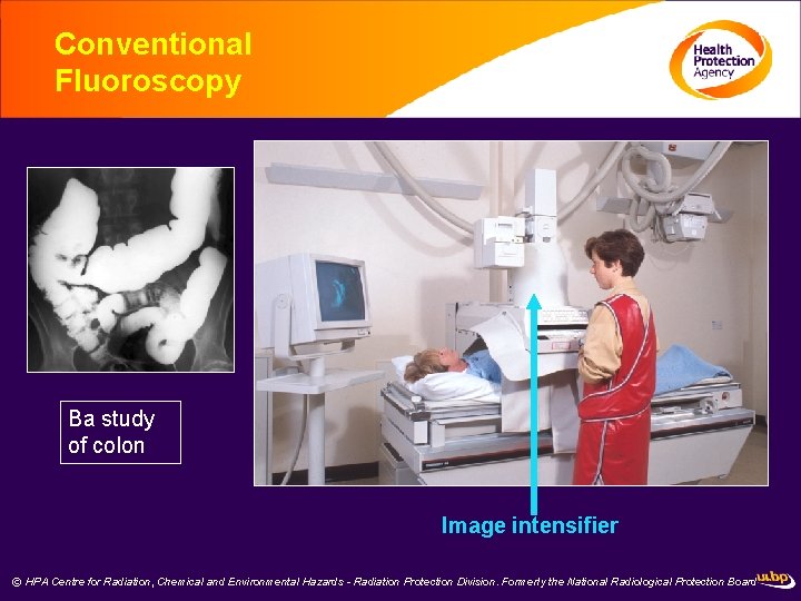 Conventional Fluoroscopy Ba study of colon Image intensifier © HPA Centre for Radiation, Chemical