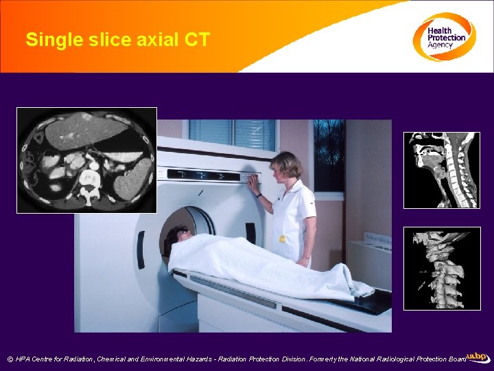 Single slice axial CT © HPA Centre for Radiation, Chemical and Environmental Hazards -