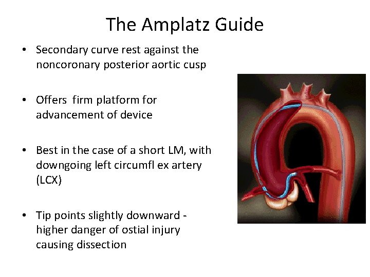 The Amplatz Guide • Secondary curve rest against the noncoronary posterior aortic cusp •