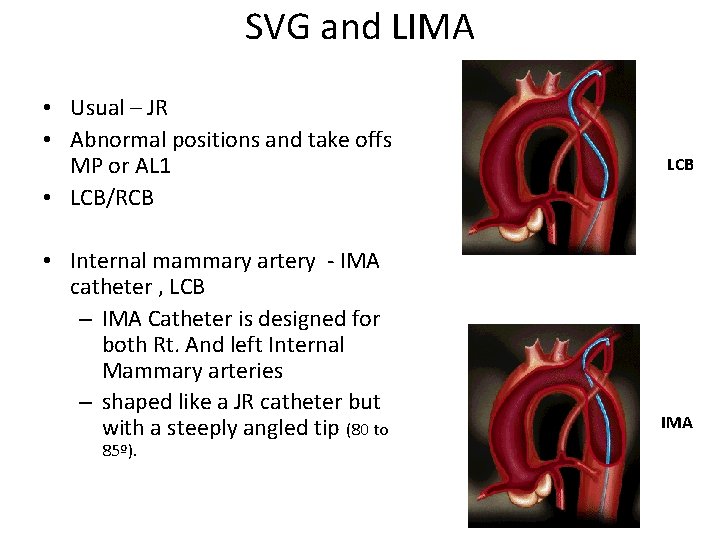 SVG and LIMA • Usual – JR • Abnormal positions and take offs MP