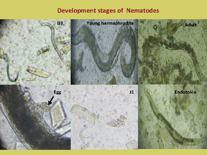 Development stages of Nematodes IJ 3 Egg Young hermaphrodite Adult J 1 Endotokia 