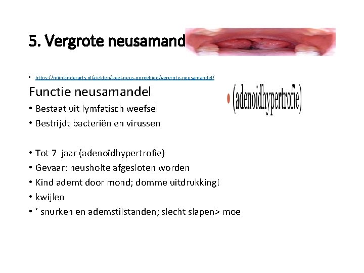 5. Vergrote neusamandel • https: //mijnkinderarts. nl/ziekten/keel-neus-oorgebied/vergrote-neusamandel/ Functie neusamandel • Bestaat uit lymfatisch weefsel