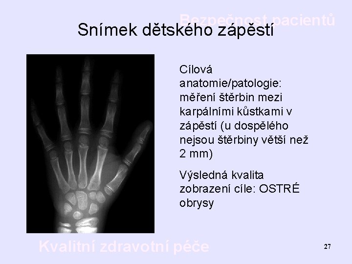 Bezpečnost pacientů Snímek dětského zápěstí Cílová anatomie/patologie: měření štěrbin mezi karpálními kůstkami v zápěstí