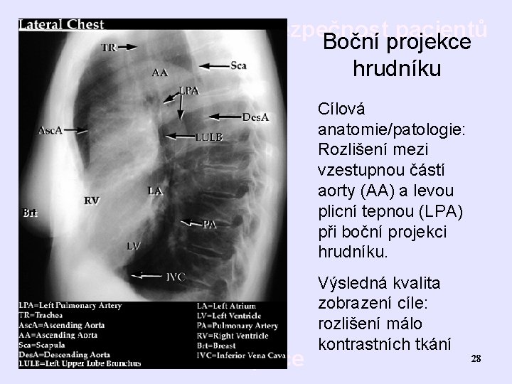 Bezpečnost pacientů Boční projekce hrudníku Cílová anatomie/patologie: Rozlišení mezi vzestupnou částí aorty (AA) a