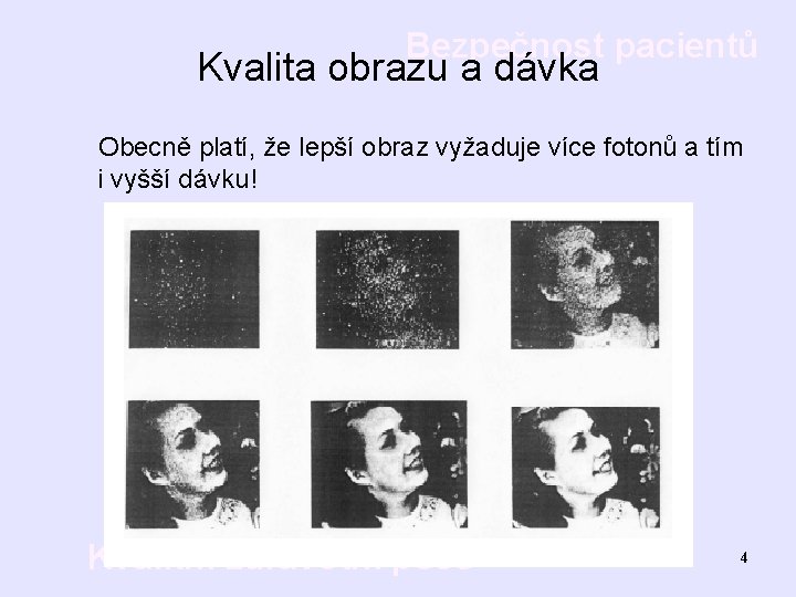 Bezpečnost pacientů Kvalita obrazu a dávka Obecně platí, že lepší obraz vyžaduje více fotonů