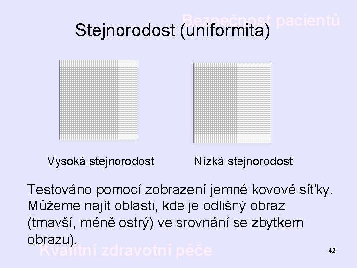 Bezpečnost pacientů Stejnorodost (uniformita) Vysoká stejnorodost Nízká stejnorodost Testováno pomocí zobrazení jemné kovové síťky.