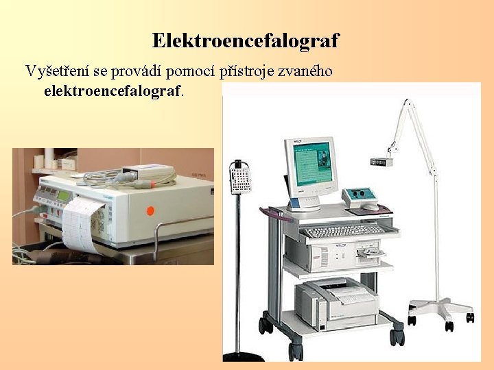 Elektroencefalograf Vyšetření se provádí pomocí přístroje zvaného elektroencefalograf. 