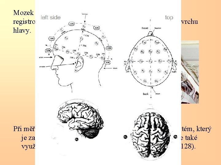 Mozek při své činnosti tvoří elektrické proudy. Ty lze registrovat speciálními elektrodami připevněnými na
