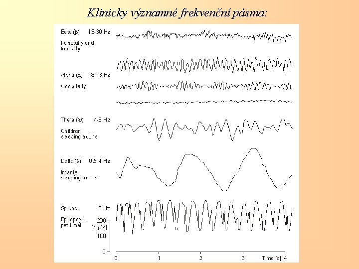Klinicky významné frekvenční pásma: 