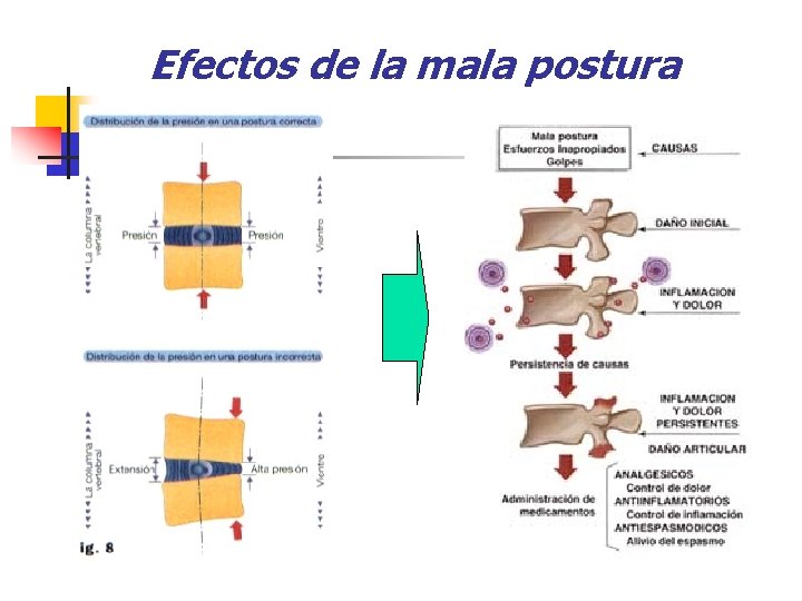 Efectos de la mala postura 