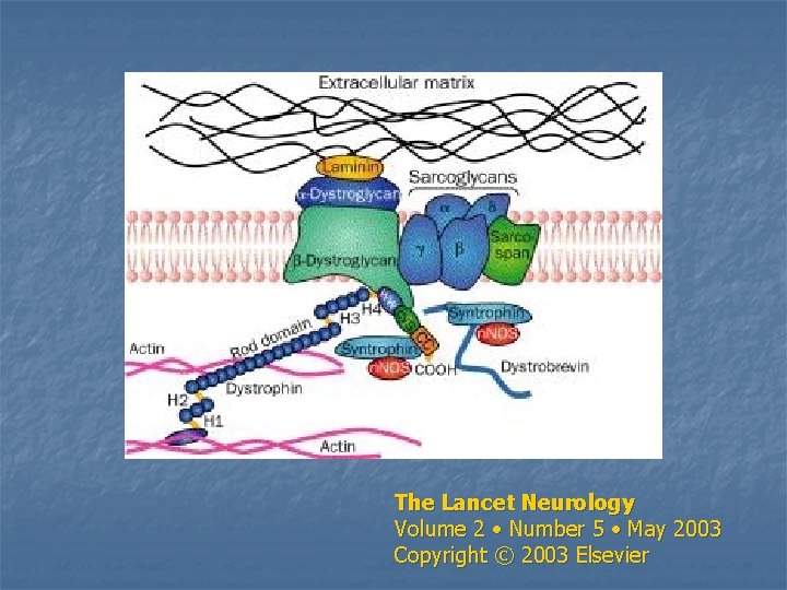 The Lancet Neurology Volume 2 • Number 5 • May 2003 Copyright © 2003