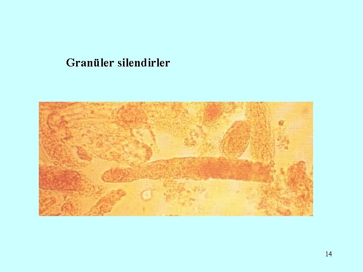 Granüler silendirler 14 