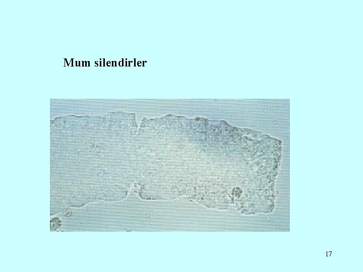 Mum silendirler 17 