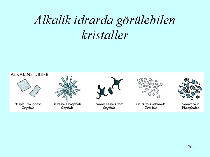 Alkalik idrarda görülebilen kristaller 26 