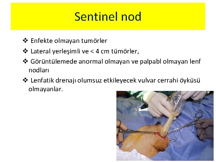 Sentinel nod v Enfekte olmayan tumörler v Lateral yerleşimli ve < 4 cm tümörler,